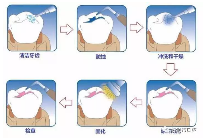 blob.png blob.png