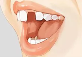 blob.png blob.png