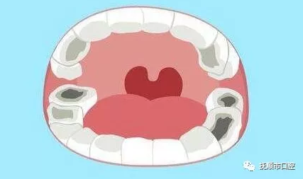 blob.png blob.png